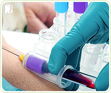 A FHS test determine the amount of follicle-stimulating hormone