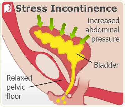 Postmenopause Symptoms3