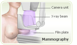 Postmenopause mammography