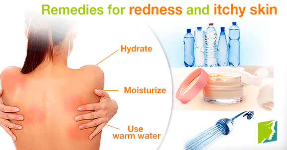 Remedies for redness and itchy skin