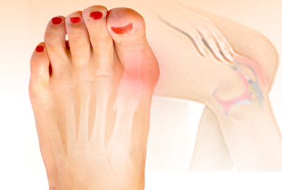 Severe Joint Pain: Causes and Treatments