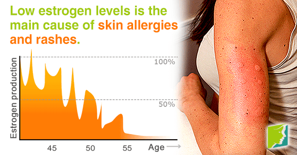 skin-allergies-and-rashes-during-menopause.png