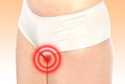 STDs and Menopause: What Every Woman Should Know