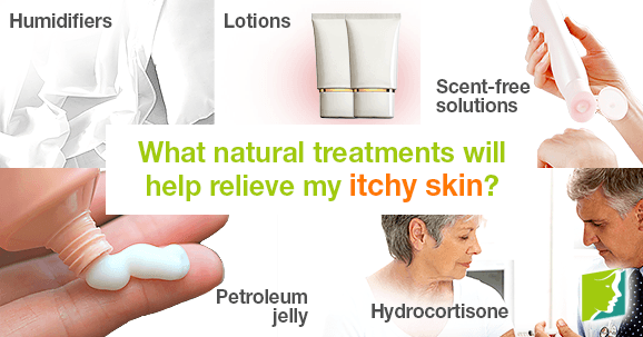 What natural treatments will help relieve my itchy skin?