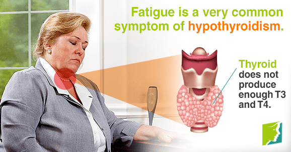 Thyroid Problems and Fatigue: Should I Be Worried?