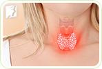 Thyroid Problems with Hot Flashes