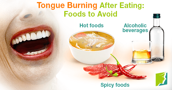 Tongue Burning After Eating: Foods to Avoid