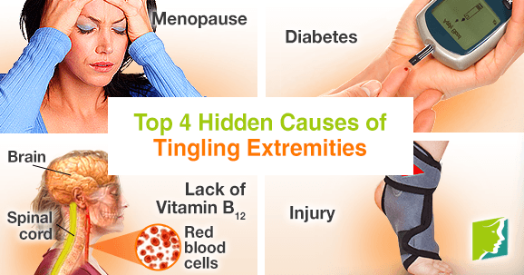 Top 4 Hidden Causes of Tingling Extremities