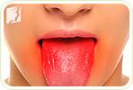 Top 4 Most Common Burning Tongue Symptoms