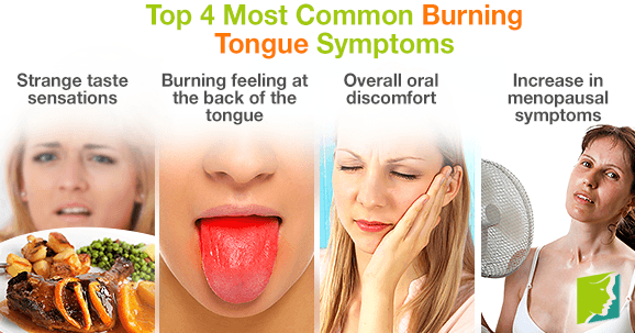 Top 4 Most Common Burning Tongue Symptoms