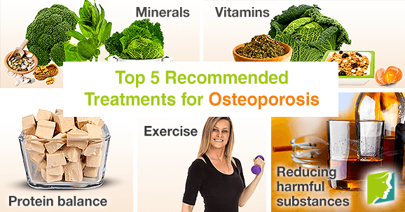 Top 5 recommended treatments for osteoporosis