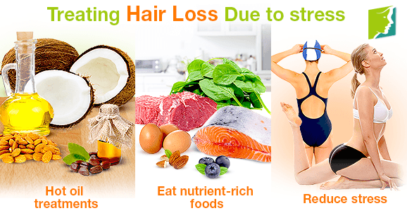 Treating Hair Loss Due to Stress