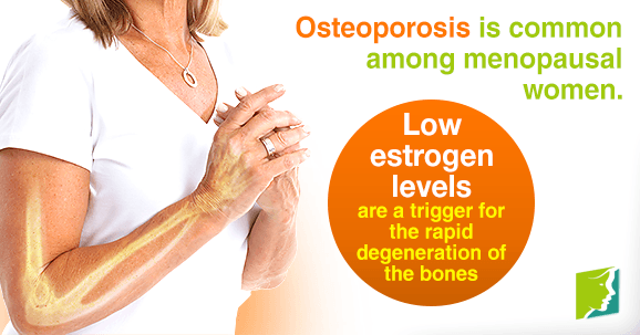 Osteoporosis is common among menopausal women