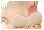 Understanding Different Types of Breast Pain