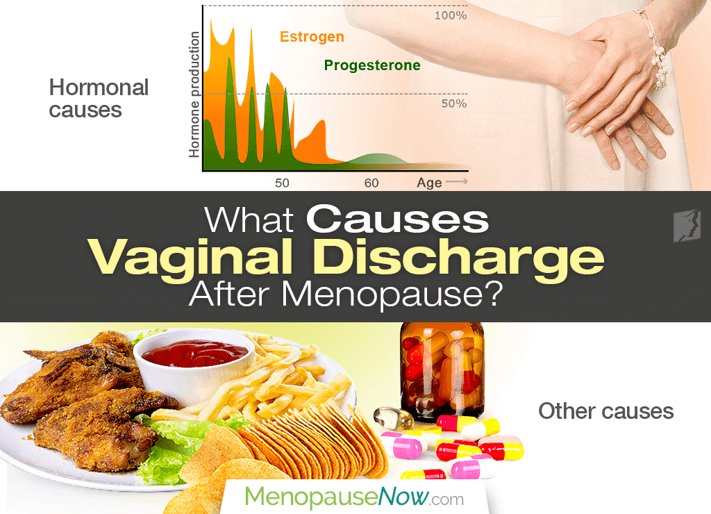 Vaginal discharge in post-menopausal women