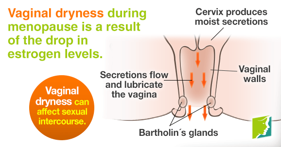 Vaginal Dryness After Menopause: Causes, Symptoms