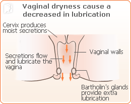 Vaginal Dryness as a Menopause Symptom