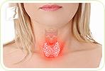 4 Differences between Thyroid Disease and Menopause