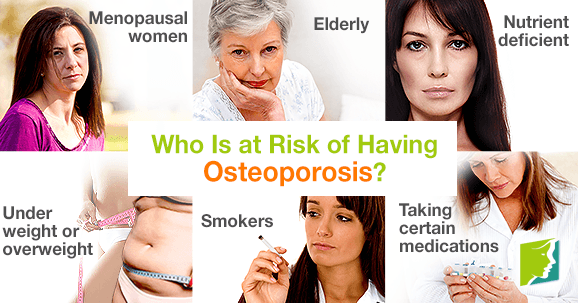 Who Is at Risk of Having Osteoporosis?