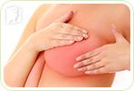 Why Are My Breasts Swollen?