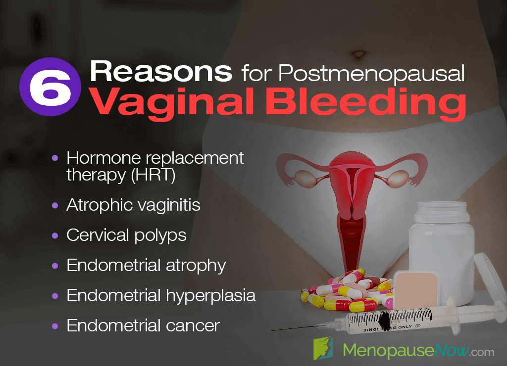 6 Causes of Vaginal Bleeding after Menopause