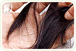 Hair Loss during Menopause